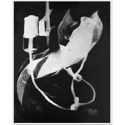 Man Ray|Man Ray Print|man ray tirage photographique argentique|Photothèque Man Ray - TELIMAGE|Startseite