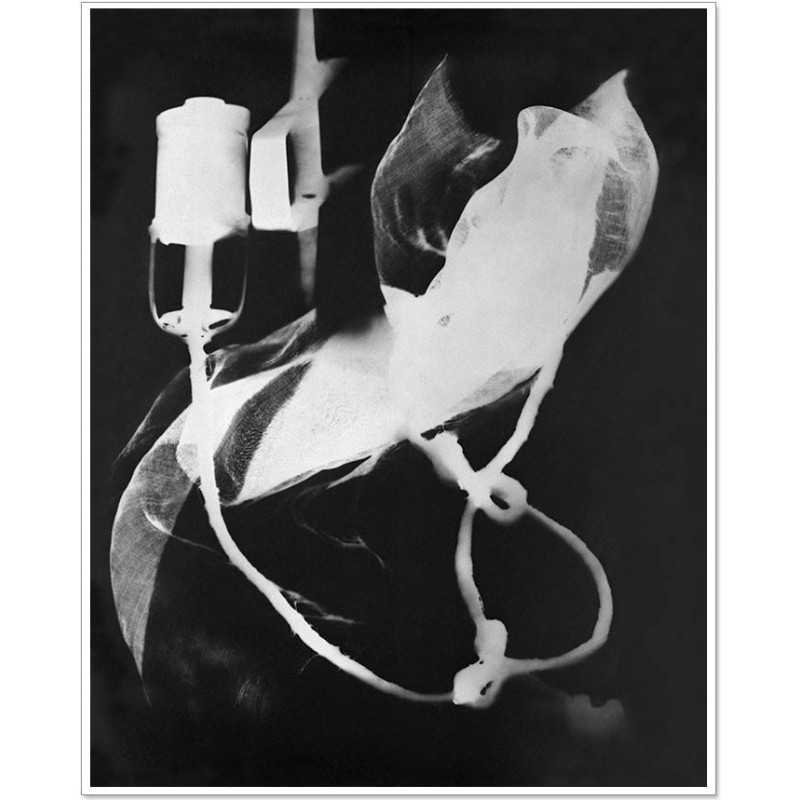 Man Ray|Man Ray Print|man ray tirage photographique argentique|Rayographie "Champs Délicieux" n° 03, 1922|156,00 €|Photothèque Man Ray - TELIMAGE