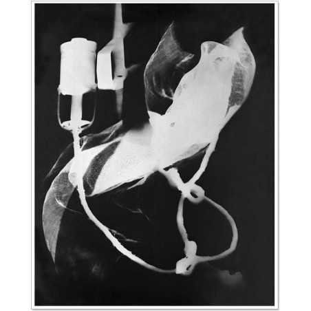 Man Ray|Man Ray Print|man ray tirage photographique argentique|Rayographie "Champs Délicieux" n° 03, 1922|156,00 €|Photothèque Man Ray - TELIMAGE